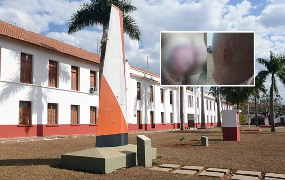 ‘Corpo gela’, ‘dor de barriga’: soldado agredido no Exército tem ataques de pânico ao lembrar de violência, diz advogado