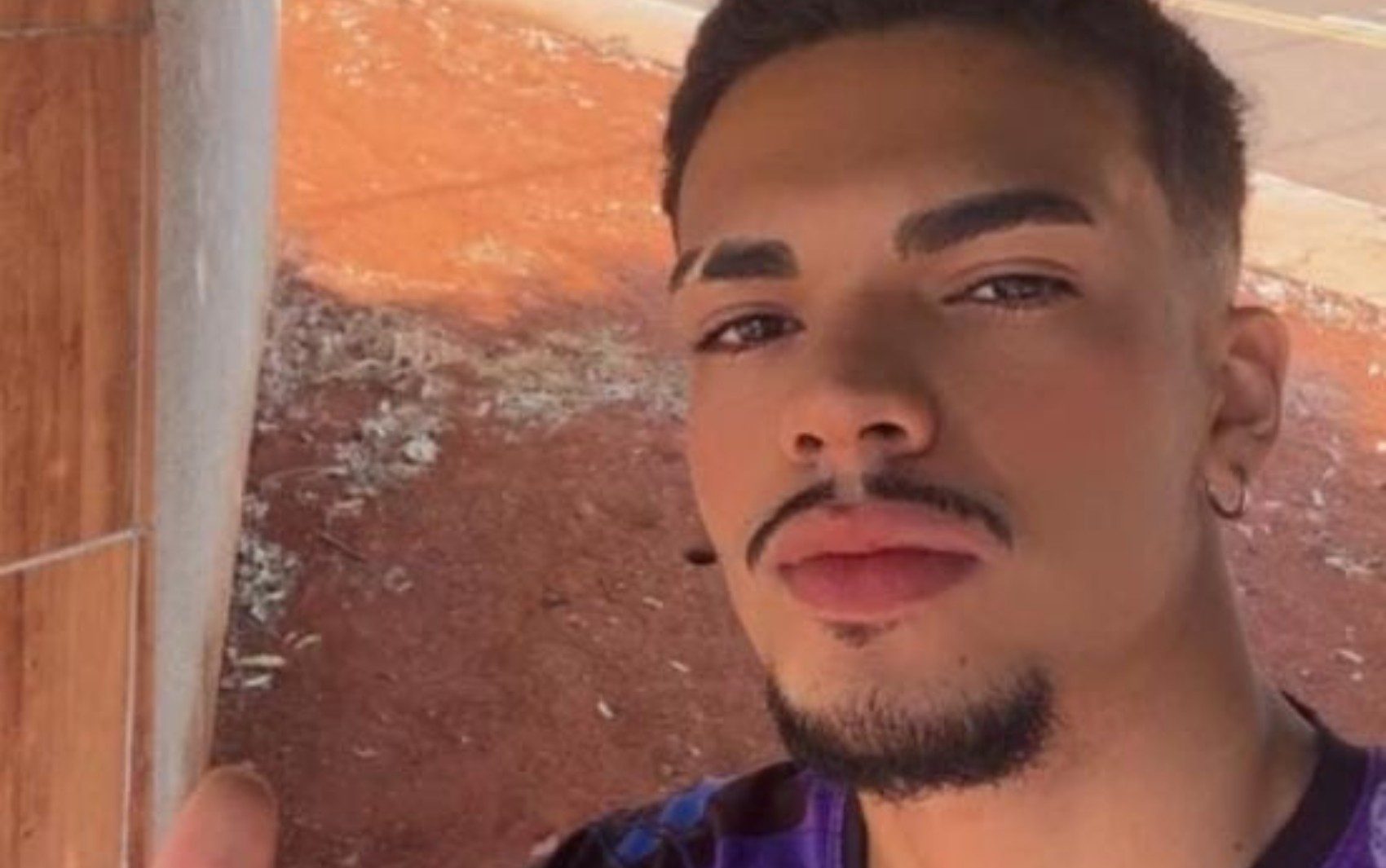 Saiba quem era o jovem que morreu aos 23 anos após fazer procedimento no pulmão