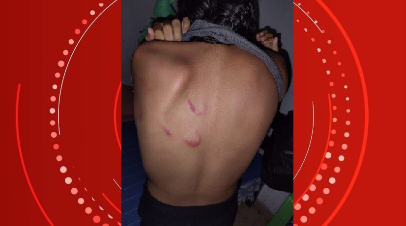 Mãe agride filha adolescente por não aceitar sua orientação sexual em Barra de Santo Antônio