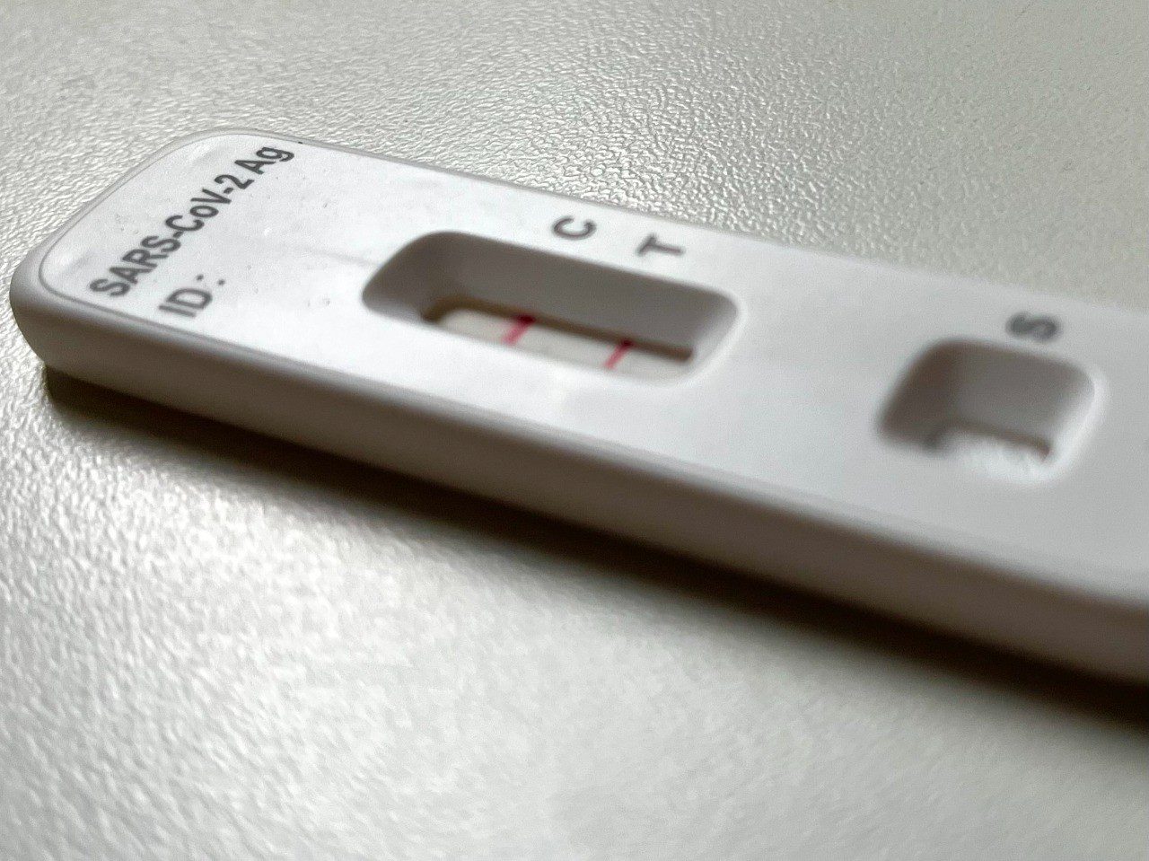 Covid-19: apesar de controlada, doença exige cuidados; DF teve 4 mortes registradas em 2025