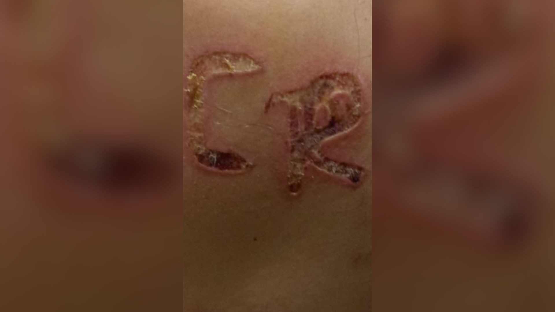 Marido é preso após marcar iniciais dele no corpo da mulher no interior de SP