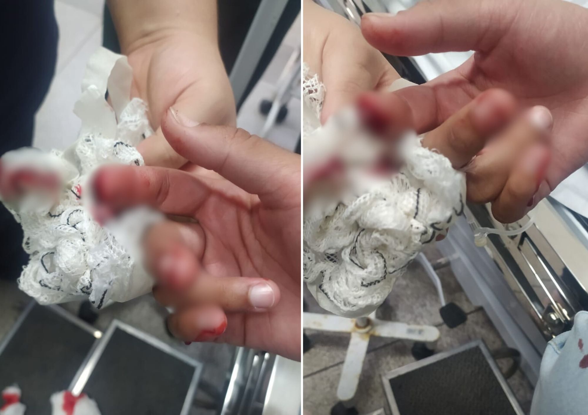 Mãe revela trauma da filha que perdeu dedo durante agressão de colegas em escola de SP