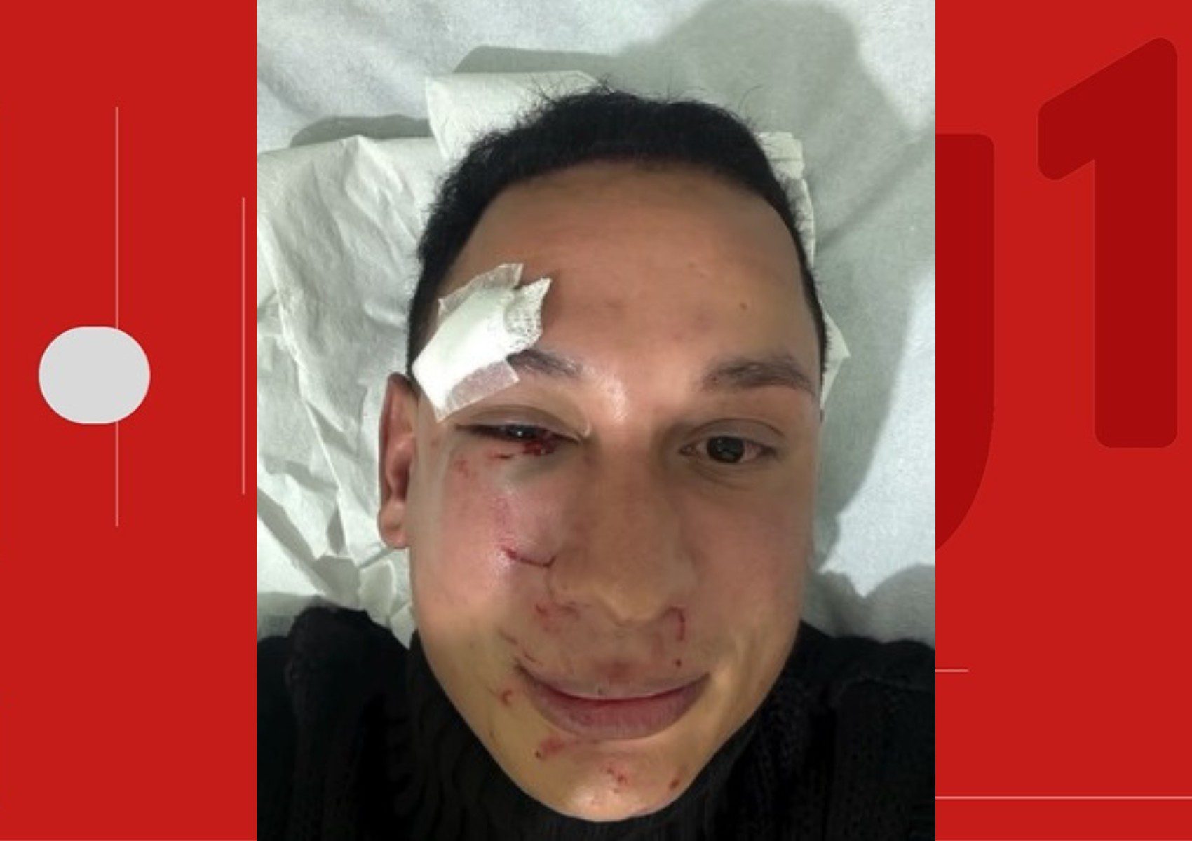 Cirurgião-dentista denuncia ter sido agredido por dois homens em camarote privado de São João na Bahia: ‘trauma físico e psicológico’