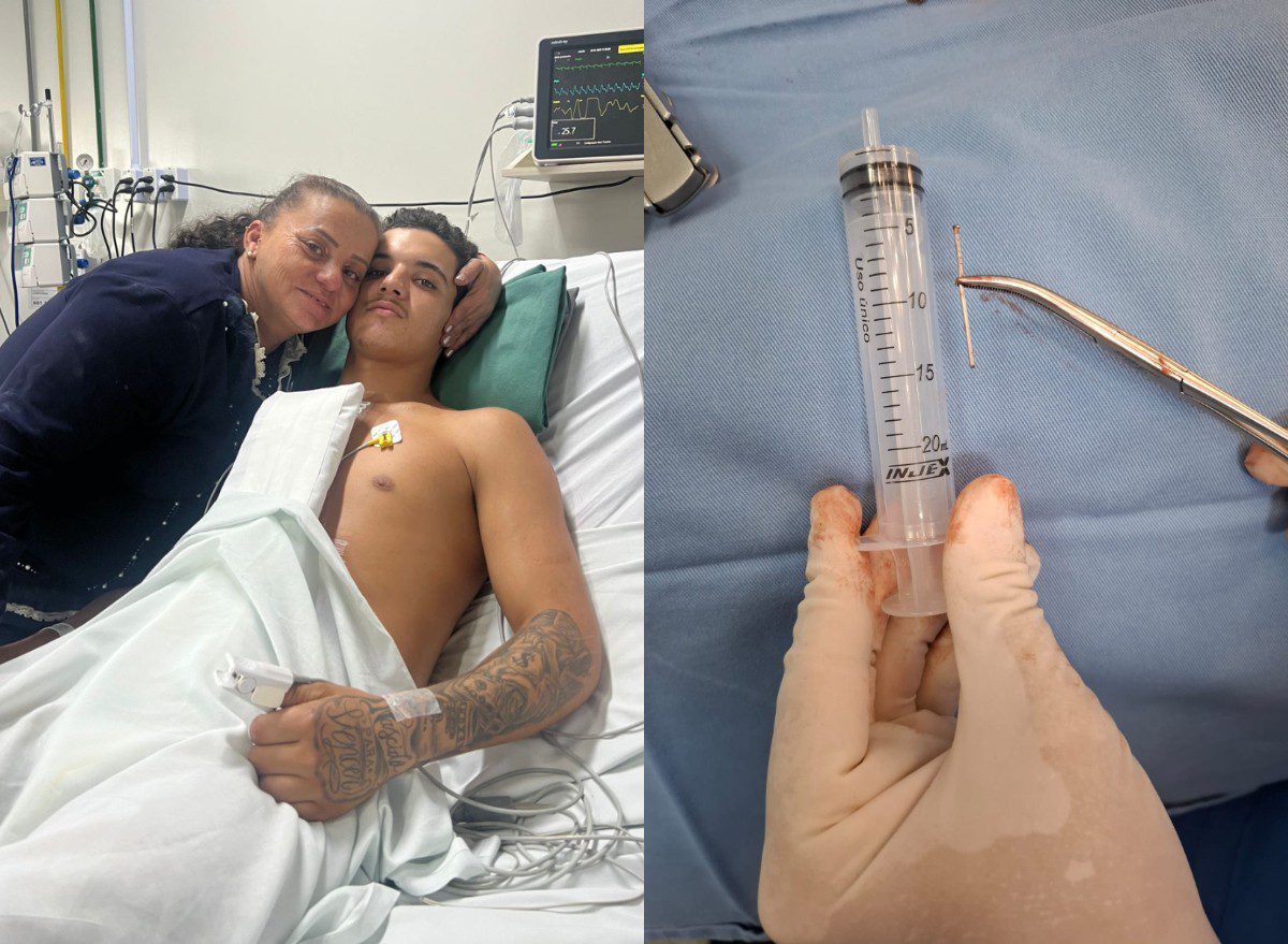 Sem querer, jovem dispara pistola de pregos no próprio coração em SC e sobrevive após ação rápida: ‘Nasci de novo’