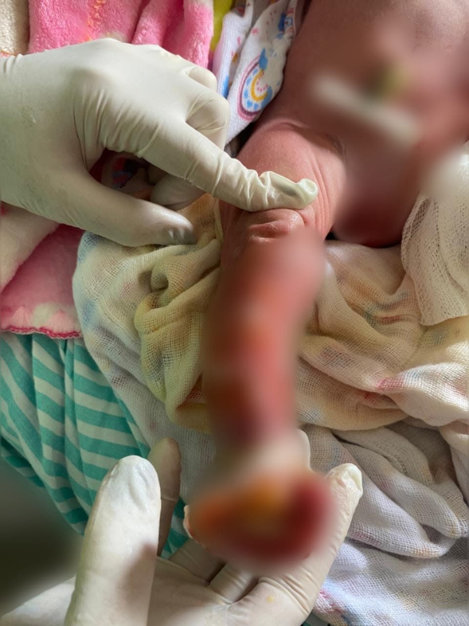 ‘Estou sem chão’, diz pai de recém-nascida internada na UTI após banho em maternidade no Acre